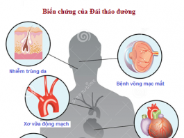 nguyên nhân và triệu chứng của bệnh đái tháo đường
