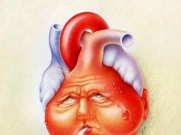 Hội chứng suy tim