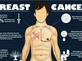 Các xét nghiệm và chẩn đoán ung thư vú ở nam giới