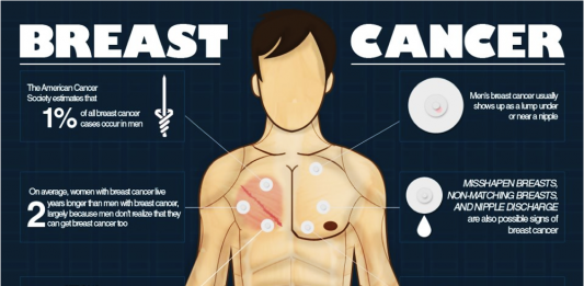 Các xét nghiệm và chẩn đoán ung thư vú ở nam giới