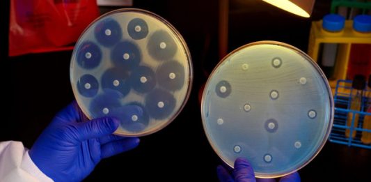 Định lượng kháng sinh bằng phương pháp lý hóa và khuếch tán trên thạch