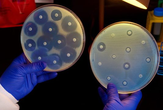 Định lượng kháng sinh bằng phương pháp lý hóa và khuếch tán trên thạch