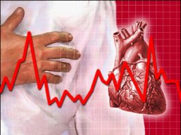 Nguyên nhân và triệu chứng của bệnh suy tim