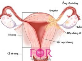 Các vấn đề thuộc cơ quan sinh sản của nam và nữ