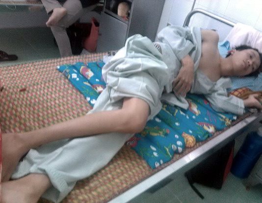 Các thương tật thứ cấp thường gặp