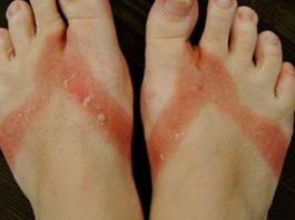 Rối loạn nước – điện giải