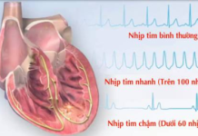 CÁC RỐI LOẠN NHỊP NHANH