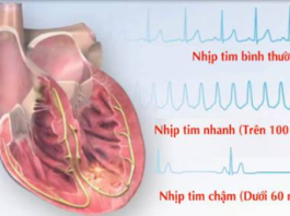CÁC RỐI LOẠN NHỊP NHANH