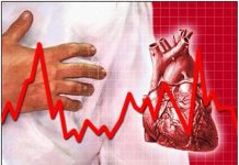 Tìm hiểu về rối loạn nhịp tim