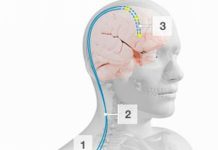 THUỐC GIẢM ĐAU TRUNG ƯƠNG