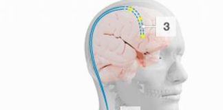 THUỐC GIẢM ĐAU TRUNG ƯƠNG