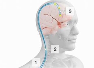 THUỐC GIẢM ĐAU TRUNG ƯƠNG