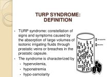 Tìm hiểu về Turp Syndrome