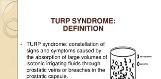 Tìm hiểu về Turp Syndrome