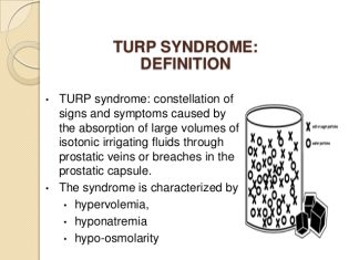 Tìm hiểu về Turp Syndrome