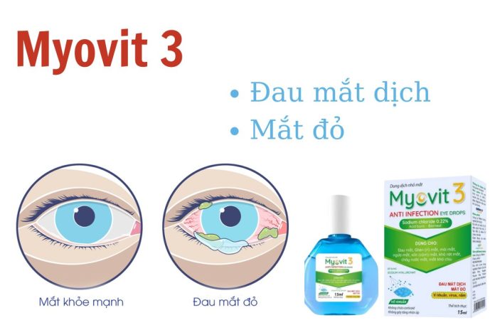 Dung dịch nhỏ mắt Myovit 3