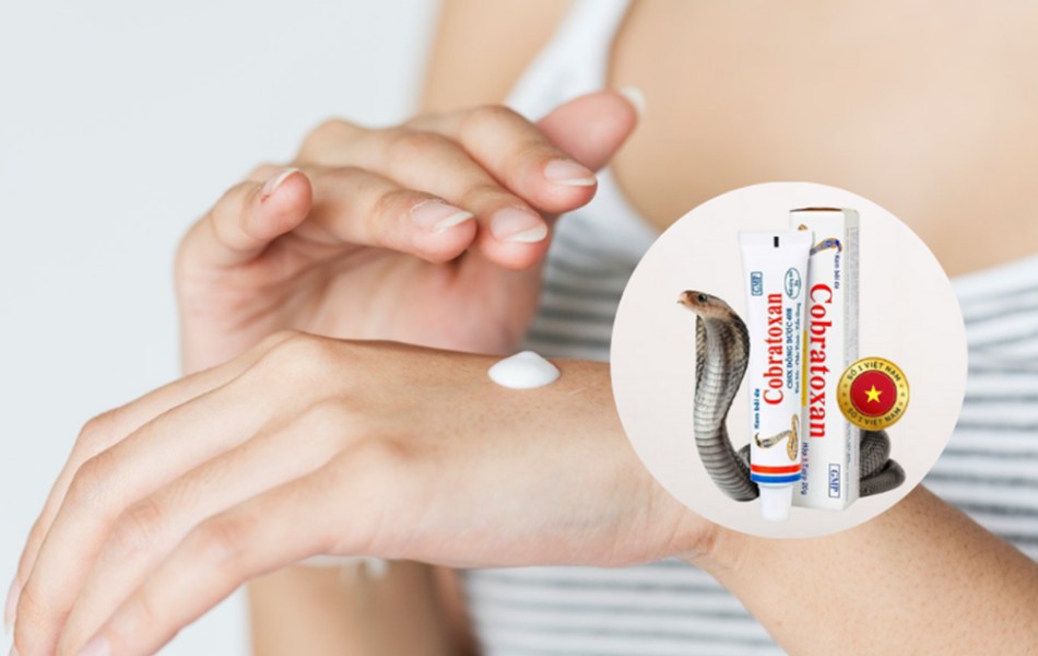 Kem xoa nọc rắn Cobratoxan đúng cách để đạt hiệu quả cao